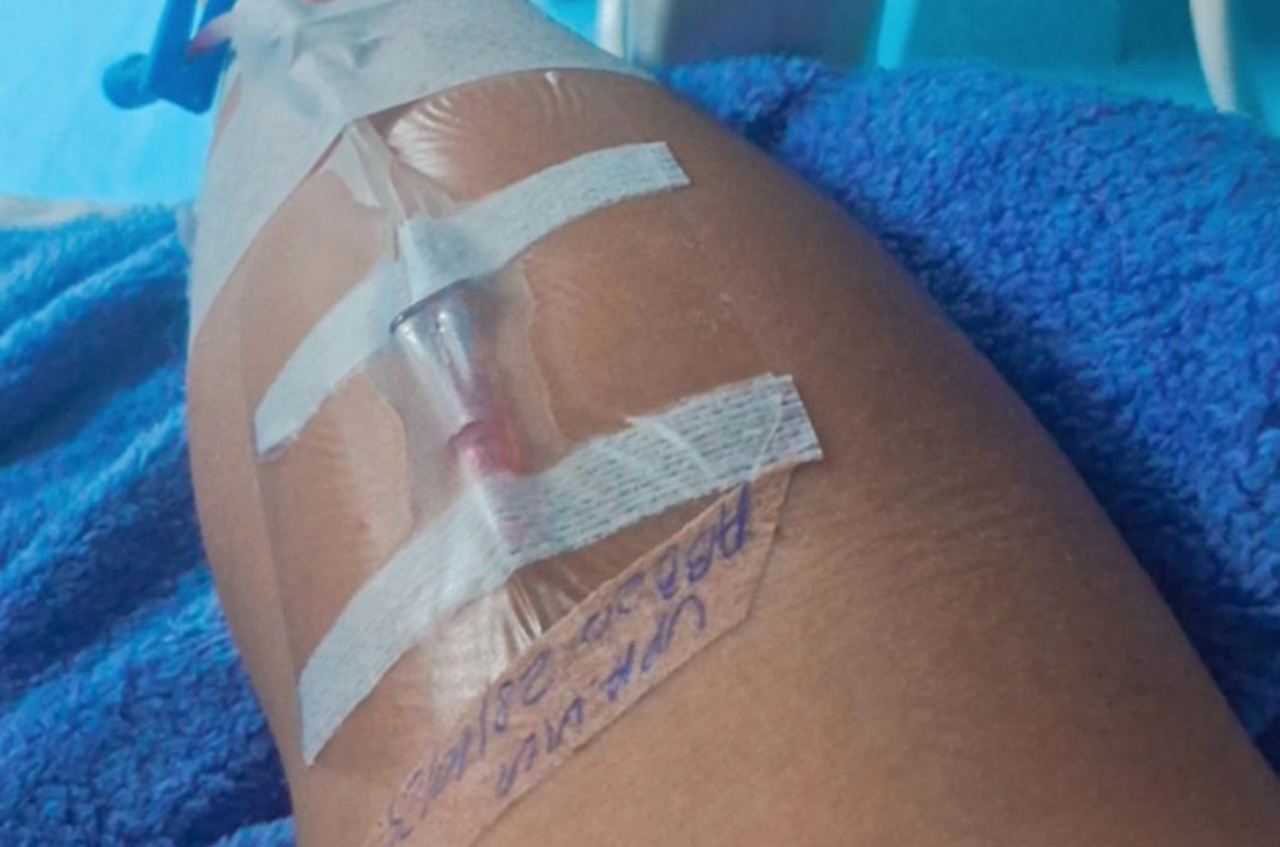 Enquanto o prefeito TikToker Guilherme Gonçalves grava vídeos, o povo sofre nas filas da UPA